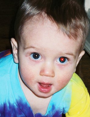 Free Red-eye Reduction Tool - Example - 1