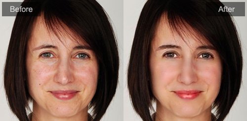 Example of Skin perfection